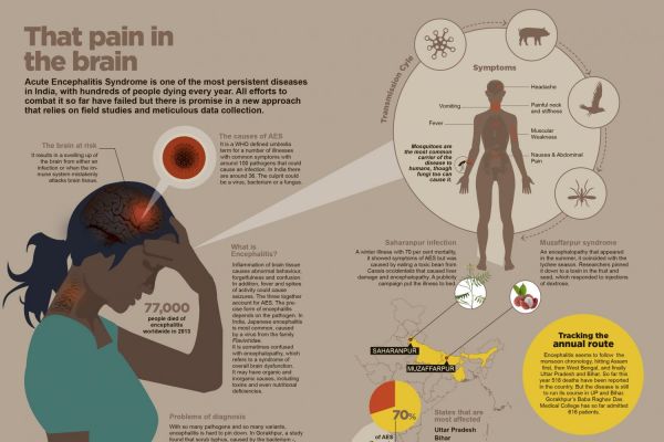 The Pain In The Brain