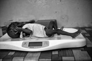 Malnutrition stalks India’s children